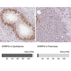 SNRPG Antibody, Novus Biologicals 25 &mu;L, Unlabeled:Antibodies, Polyclonal
